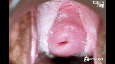 Examen ginecológico de una hermosa mujer
